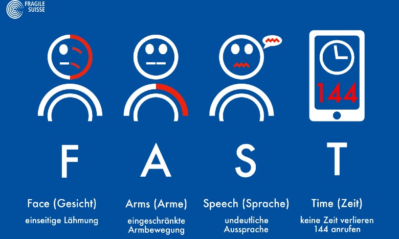 FAST-Test Eine Grafik, die den FAST-Test zeigt. Die Symptome eines Schlaganfall werden mit Strichmännchen und Text erläutert: einseitige Lähmung im Gesicht, eingeschränkte Armbewegung, undeutliche Aussprache und keine Zeit verlieren - 144 anrufen.